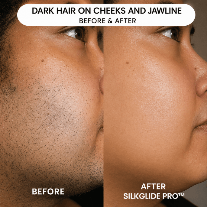 Mazenzo SilkGlide Pro™ | 2-in-1 Facial Hair Remover