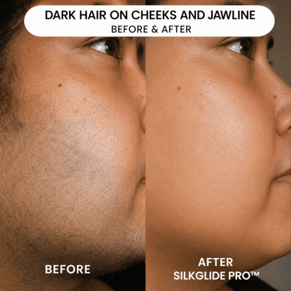 Mazenzo SilkGlide Pro™ | 2-in-1 Facial Hair Remover